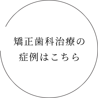 矯正歯科治療の症例はこちら